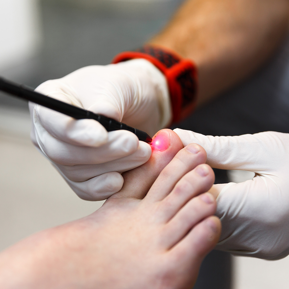 My FootDr Podiatrists Hope Island | shop 5/10 Santa Barbara Rd, Hope Island QLD 4212, Australia | Phone: (07) 5656 2400