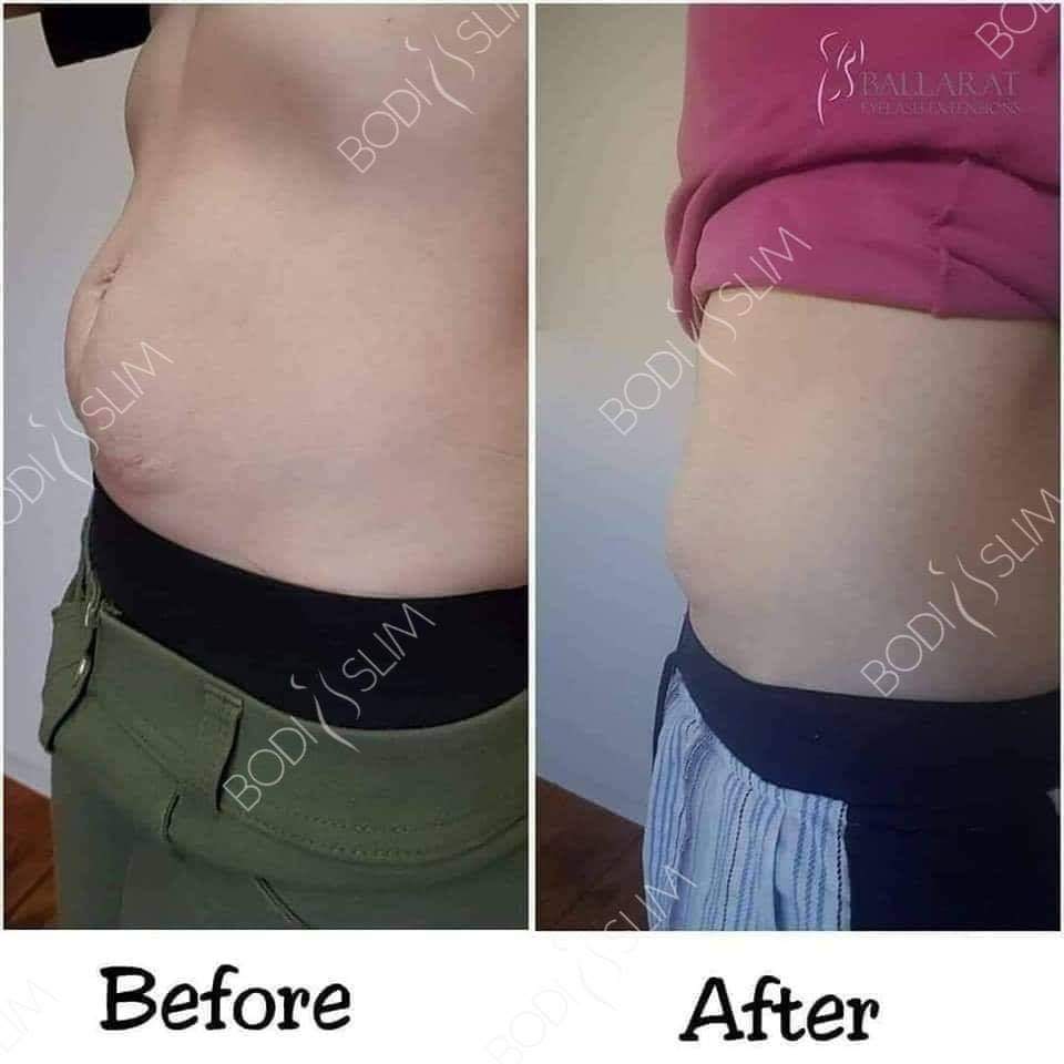 Bodi Slim | 160 Canadian Lakes Blvd, Canadian VIC 3350, Australia | Phone: 0422 120 881