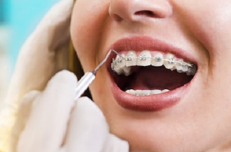 Carina Dental Practice - Dr. Stiina Leinonen | dentist | 145 Winstanley St, Carina Heights QLD 4152, Australia | 0738430633 OR +61 7 3843 0633