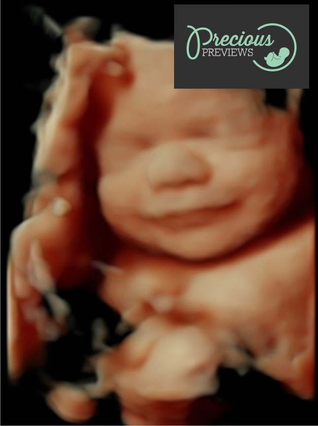 Precious Previews 3d/4d Ultrasound & Pregnancy Massage | health | 2/270 Browns Plains Rd, Browns Plains QLD 4118, Australia | 0738008999 OR +61 7 3800 8999