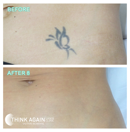 Think Again Laser Clinic |  | 2/188-190 Victoria Rd, Rozelle NSW 2039, Australia | 1300166465 OR +61 1300 166 465