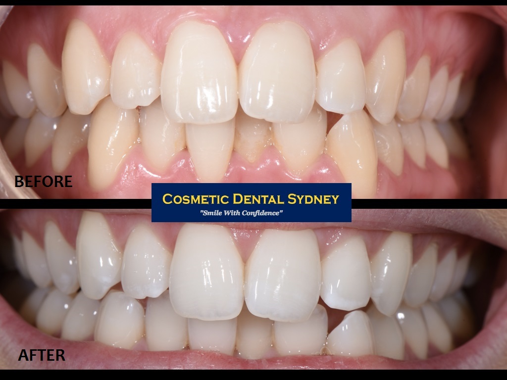 Cosmetic Dental Sydney | dentist | suite 2/40-42 Montgomery St, Kogarah NSW 2217, Australia | 0295883979 OR +61 2 9588 3979