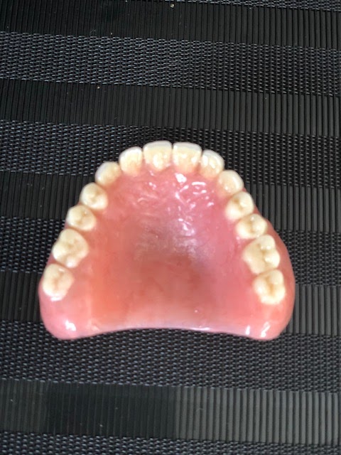 My Denture Clinic Moree | Leon Dobrinski Prosthetist | 4/88 Balo St, Moree NSW 2400, Australia | Phone: 1300 134 408