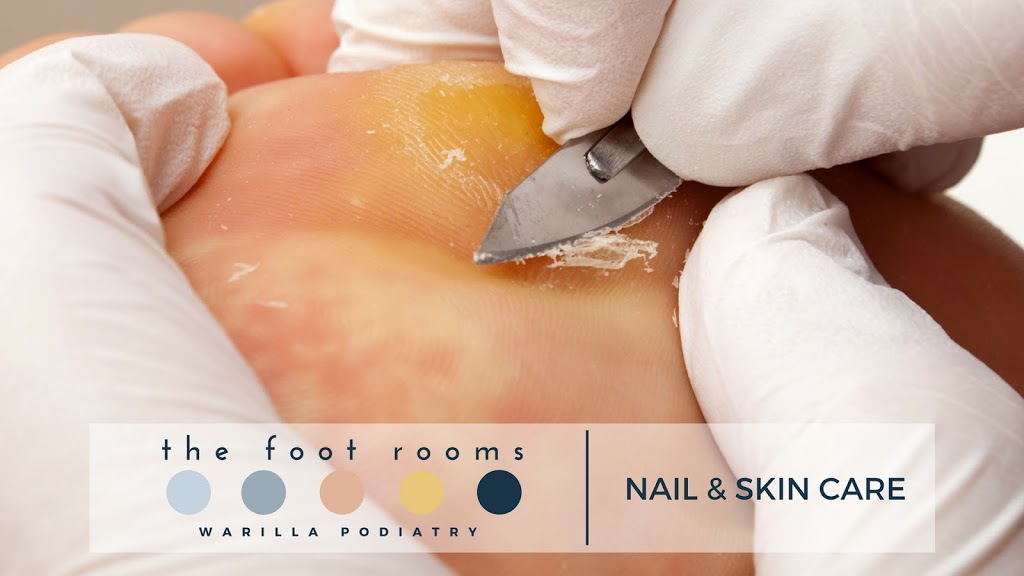 The Foot Rooms Warilla | doctor | shop 2/12-14 George St, Warilla NSW 2528, Australia | 0242631268 OR +61 2 4263 1268