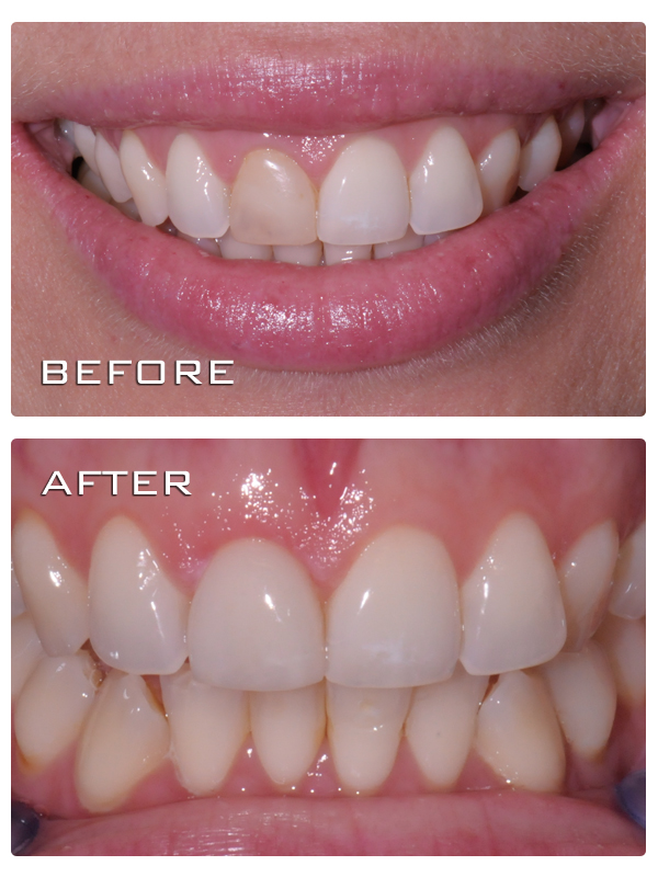 Kaleen Laser Dental & Facial Aesthetics | dentist | 149 Maribyrnong Ave, Kaleen ACT 2617, Australia | 0262416718 OR +61 2 6241 6718