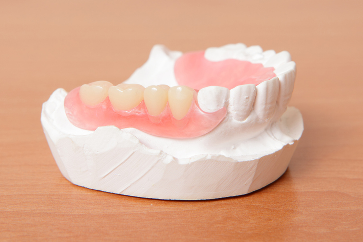 About Dentures and Mouthguards | health | 1794 Lower Gold Coast Hwy, Burleigh Heads QLD 4220, Australia | 0755350561 OR +61 7 5535 0561