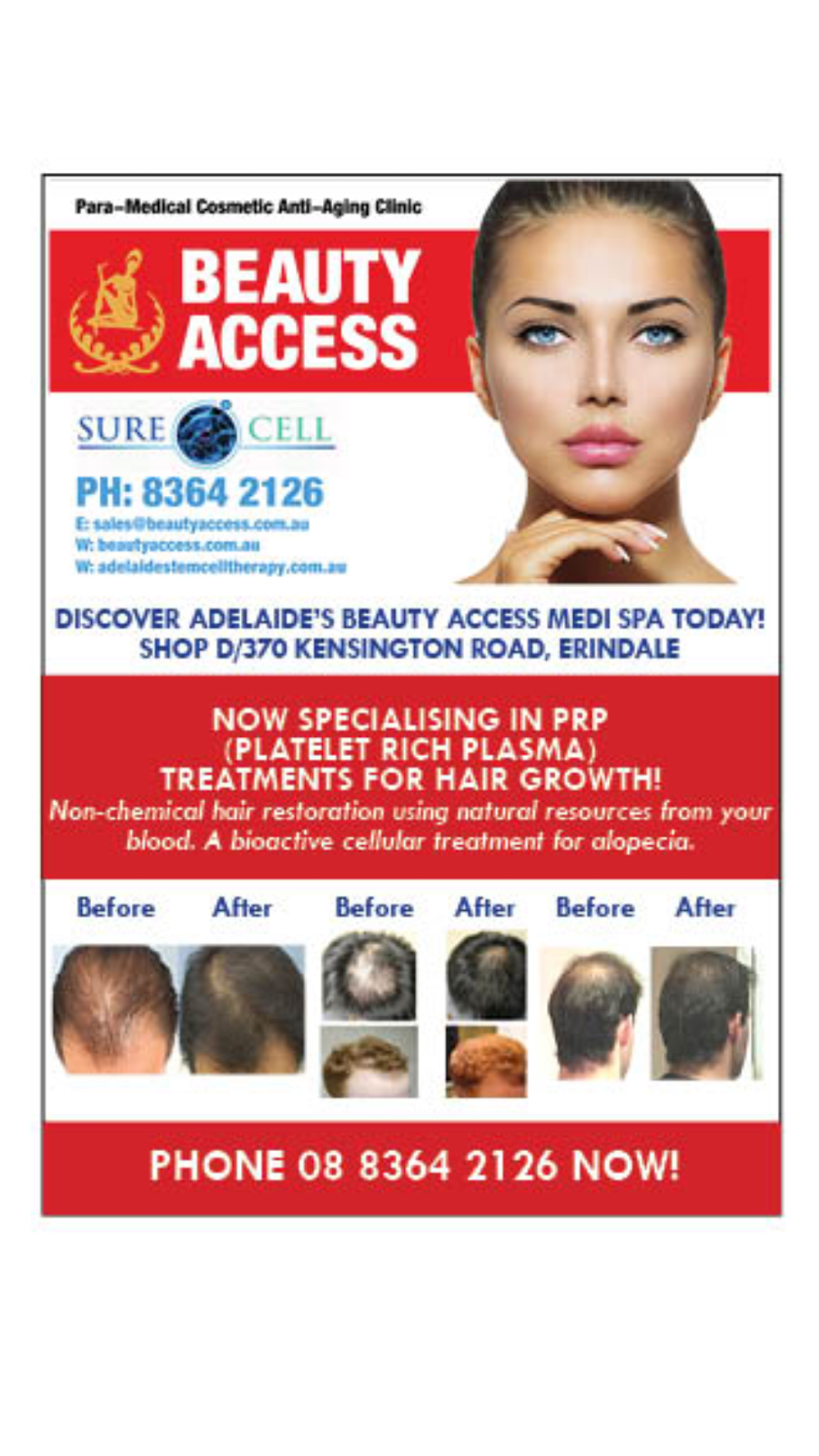 Beauty Access - Paramedical Cosmetic Antiaging Clinic | hair care | Shop D/370 Kensington Rd, Erindale SA 5066, Australia | 0883642126 OR +61 8 8364 2126