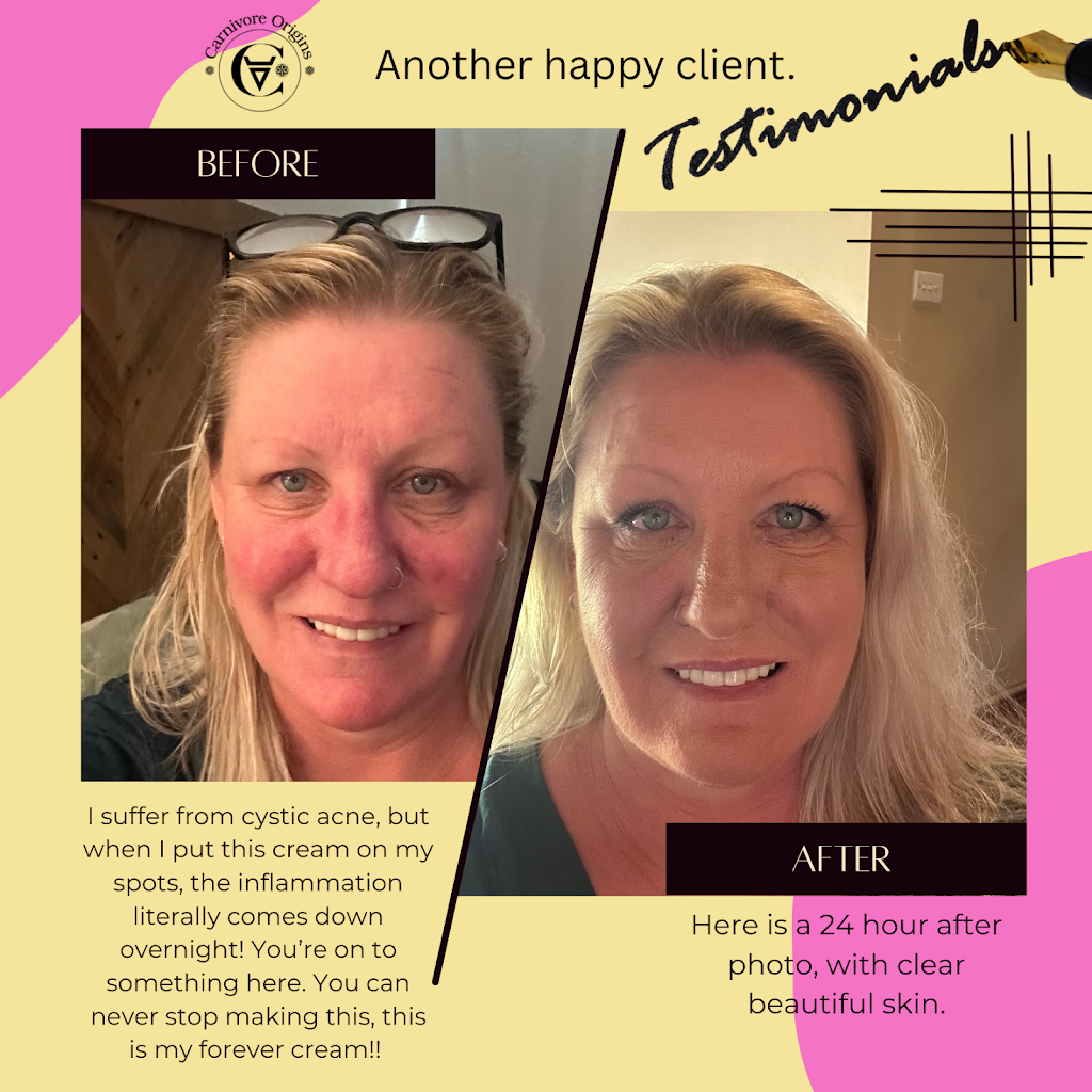 Carnivore Origins Tallow Skincare | 26 Avondale Rd, Morwell VIC 3840, Australia | Phone: 0407 718 608
