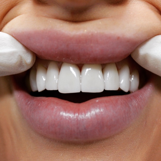 DVine Smiles Dental and Cosmetic Clinic | dentist | 101 Grimshaw St, Greensborough VIC 3088, Australia | 0394340450 OR +61 3 9434 0450