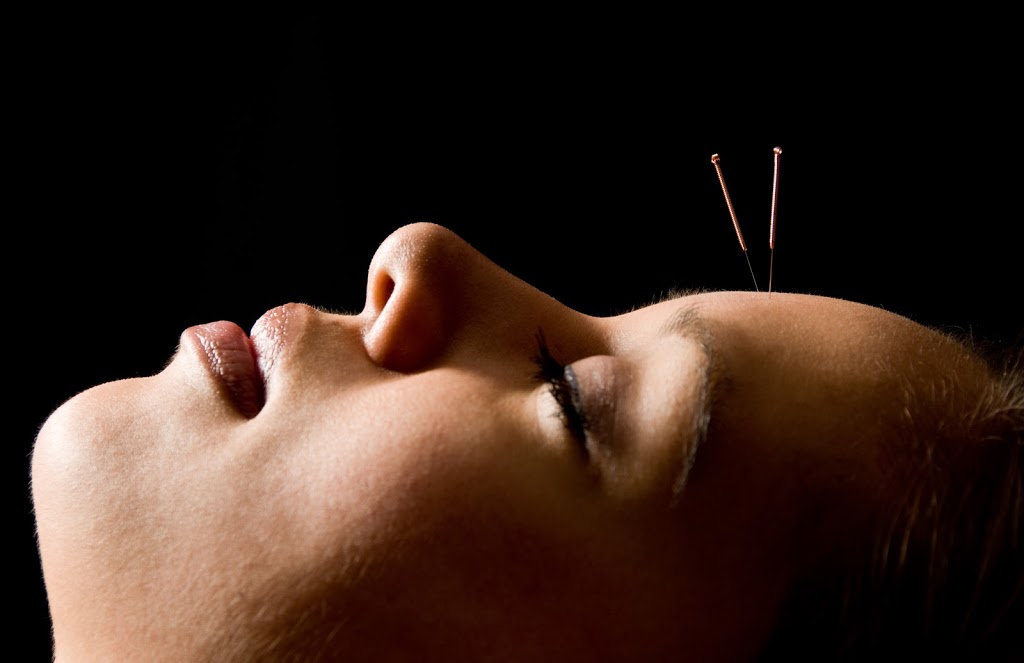 Nurturing life- Acupuncture in Upwey with April Wood (1/1579 Burwood Hwy) Opening Hours