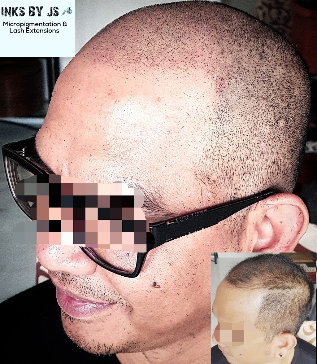 Scalp Micropigmentation SMP Melbourne Inks by JS | hair care | Sayers Rd, Tarneit VIC 3029, Australia | 0421844551 OR +61 421 844 551