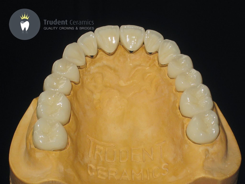 Trudent Ceramics | dentist | Unit 2/33 Mcclares Rd, Vermont VIC 3133, Australia | 0398933584 OR +61 3 9893 3584