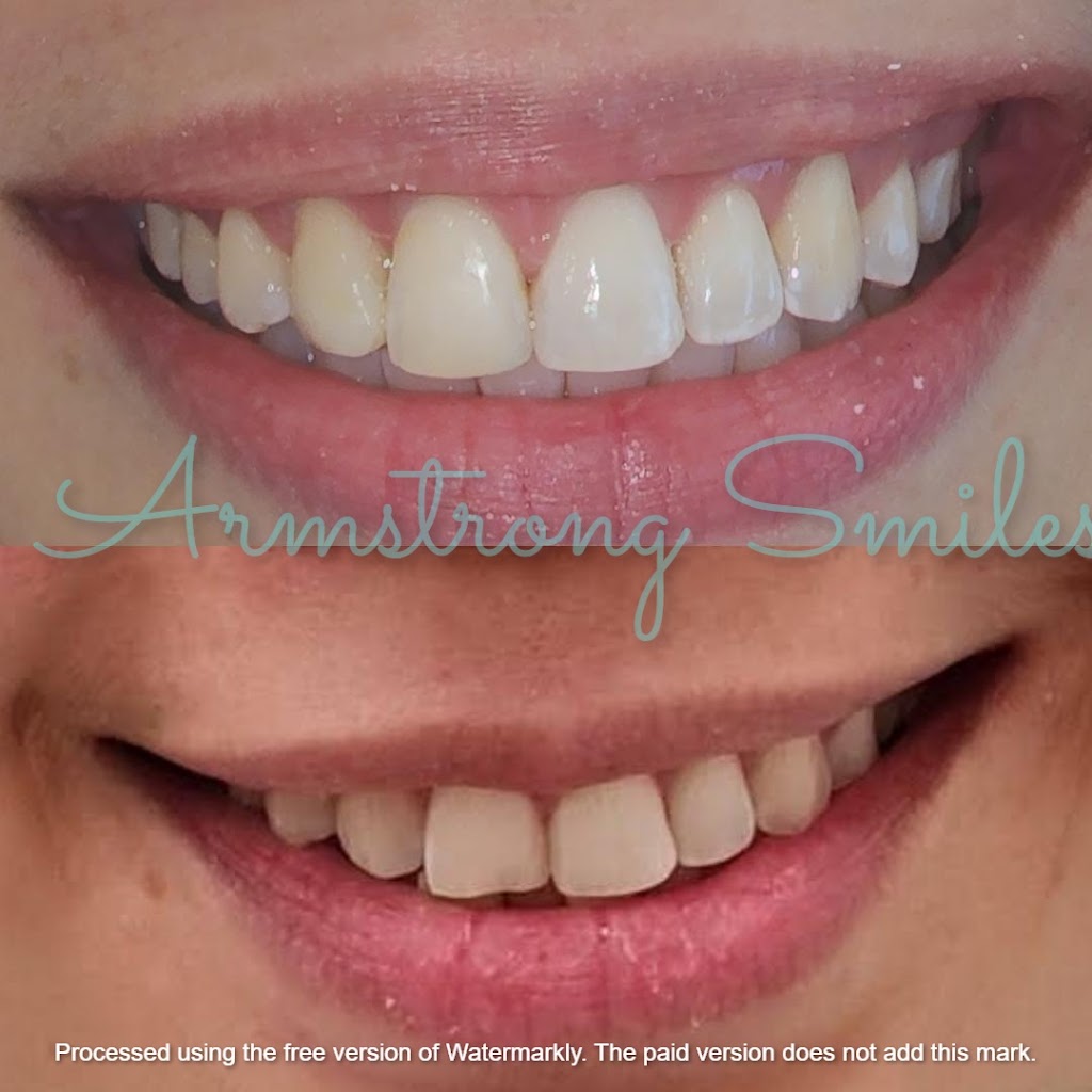 Armstrong Smiles | T01/500 - 540 Torquay Rd, Armstrong Creek VIC 3217, Australia | Phone: (03) 5215 1333