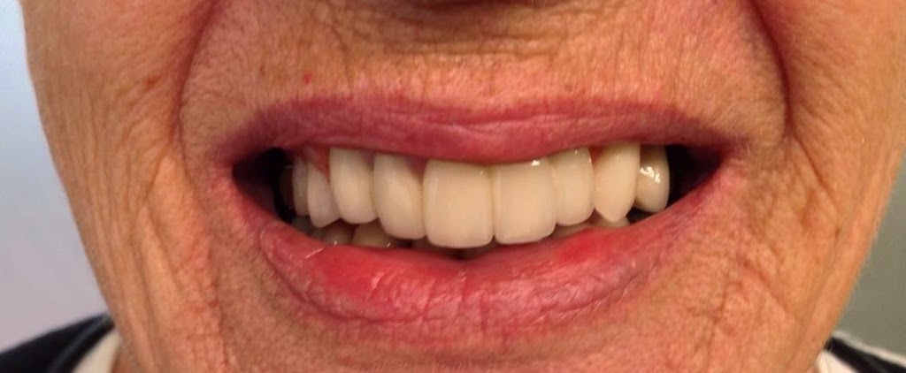 Cernus Dental Clinic & Laboratories | dentist | 139 Heaths Rd, Hoppers Crossing VIC 3029, Australia | 0397490834 OR +61 3 9749 0834