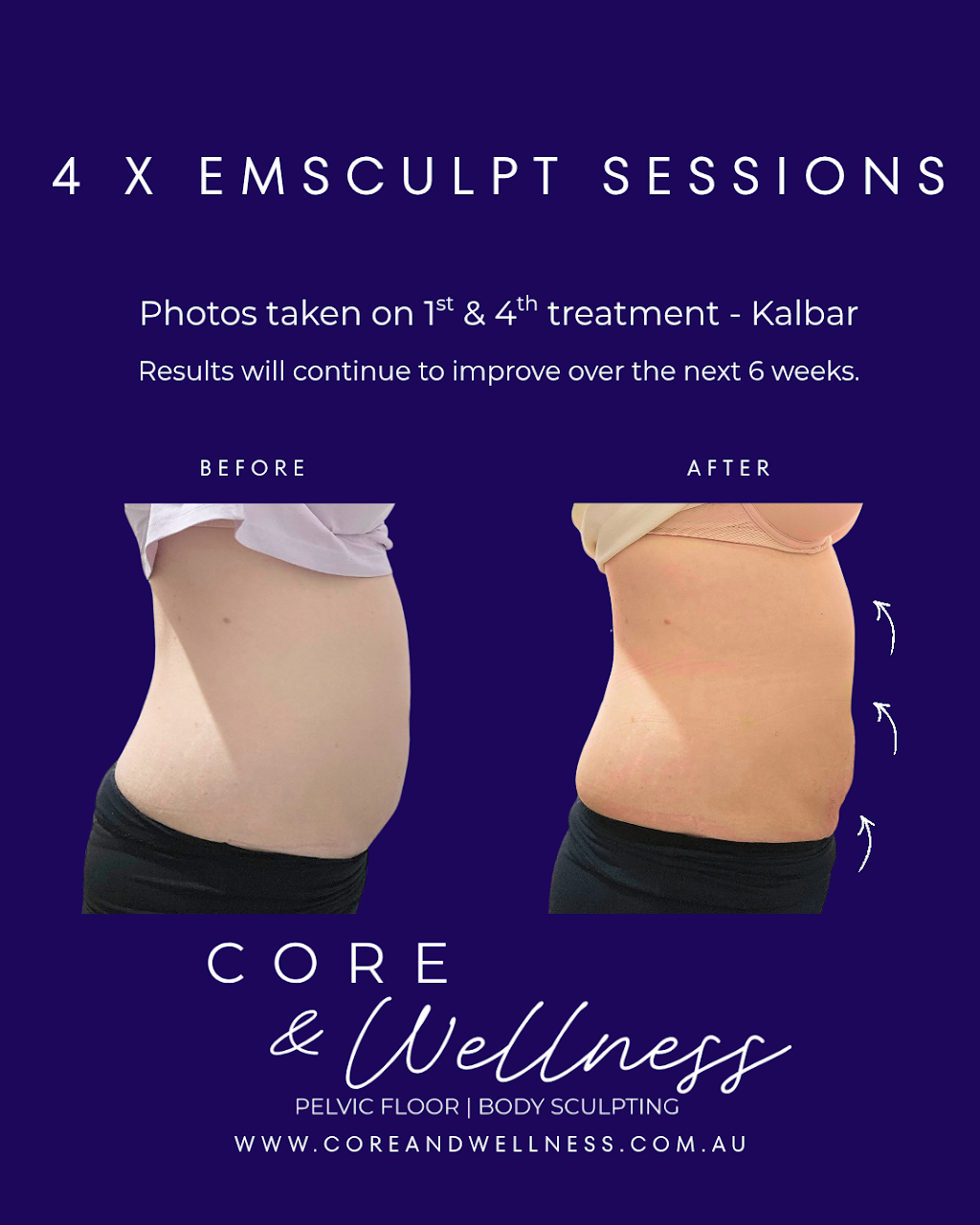Core & Wellness | Unit 7/89 George St, Kalbar QLD 4305, Australia | Phone: 0430 130 133