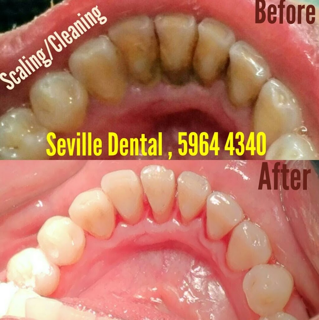 Seville Dental Clinic | Shop 13/547-567 Warburton Hwy, Seville VIC 3139, Australia | Phone: 0359644340