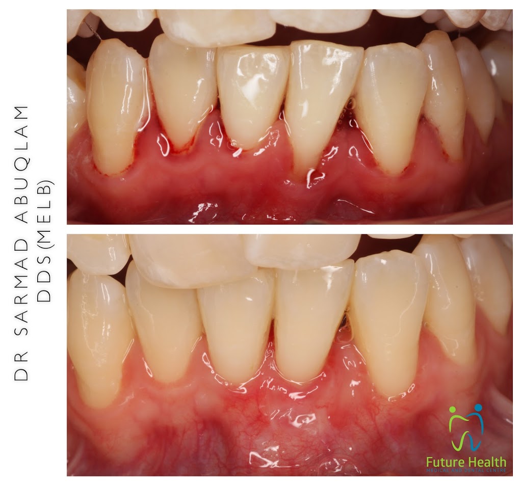 Dr Sarmad Abuqlam | Dentist | dentist | 142 Maribyrnong Rd, Moonee Ponds VIC 3039, Australia | 0390786259 OR +61 3 9078 6259