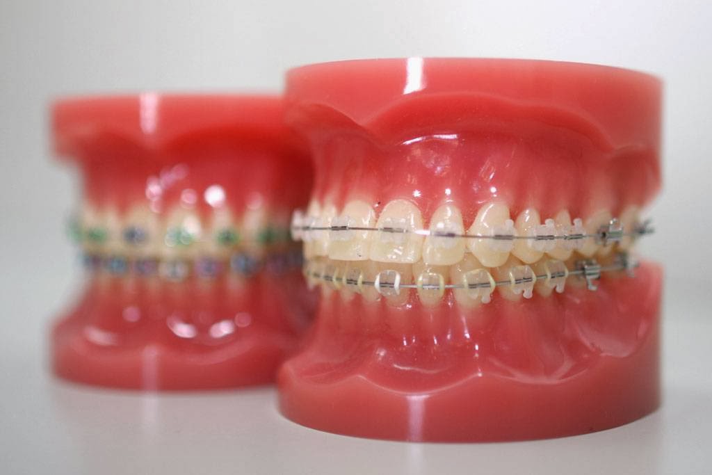 ONiA Orthodontic Network in Adelaide (Ceduna) | 3 Eyre Hwy, Ceduna SA 5690, Australia | Phone: (08) 8227 0336