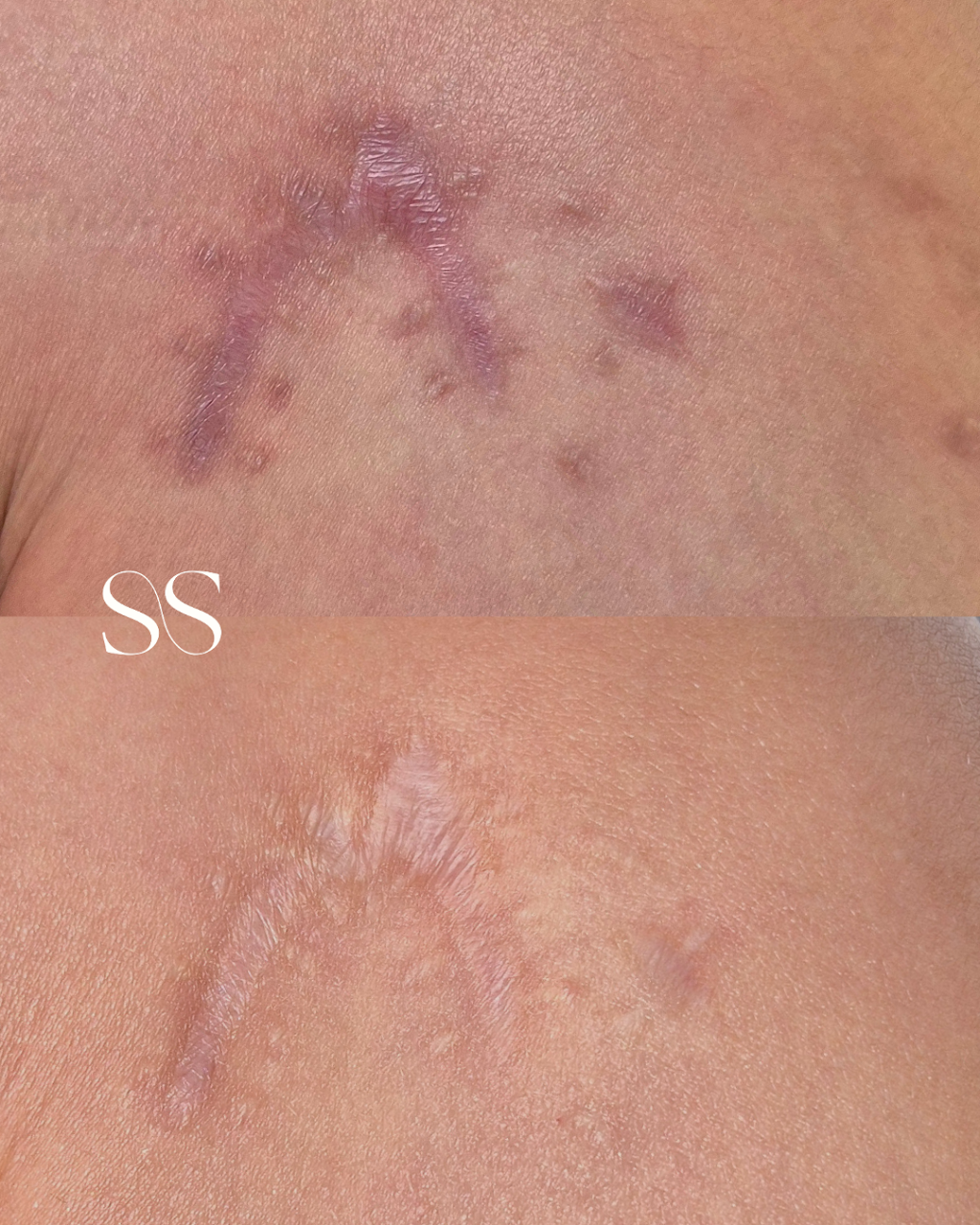 Second Skin By Lauren | 5/141 Maudsland Rd, Oxenford QLD 4210, Australia | Phone: 0480 735 455