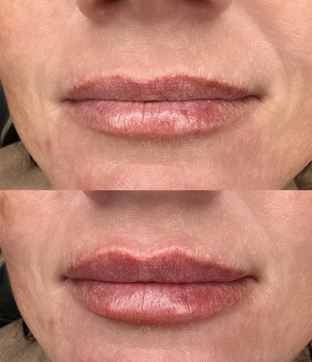 LULA AESTHETICS | 13 Harold St, Wendouree VIC 3355, Australia | Phone: 0411 667 116