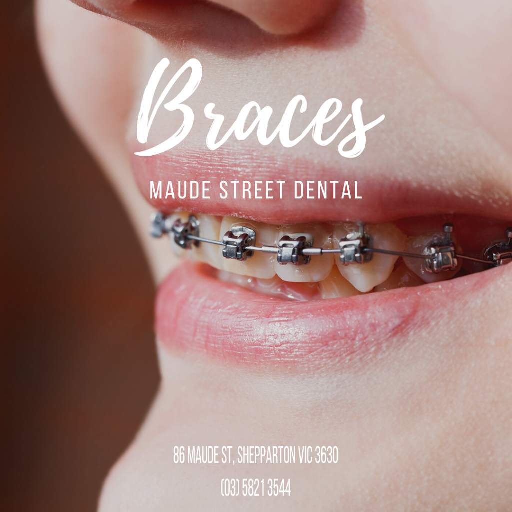 Maude Street Dental | dentist | 86 Maude St, Shepparton VIC 3630, Australia | 0358213544 OR +61 3 5821 3544