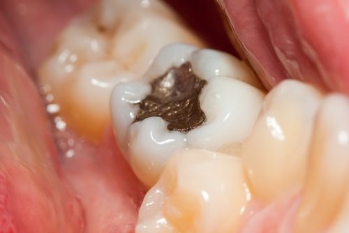 The White Bite | dentist | 1/3029 The Blvd, Carrara QLD 4211, Australia | 0755799333 OR +61 7 5579 9333