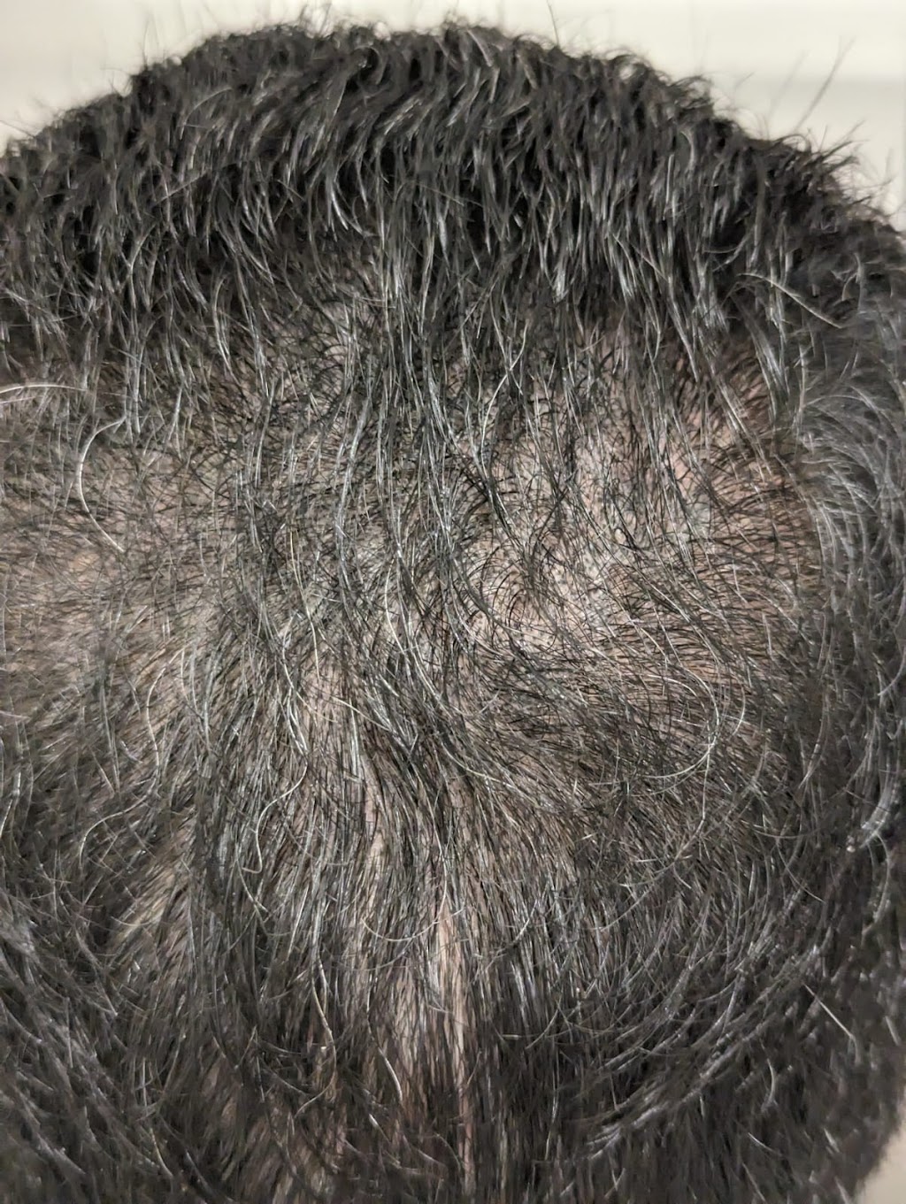 East Coast Hair ink | 1/86 Quambone St, Worongary QLD 4213, Australia | Phone: 0406 739 124