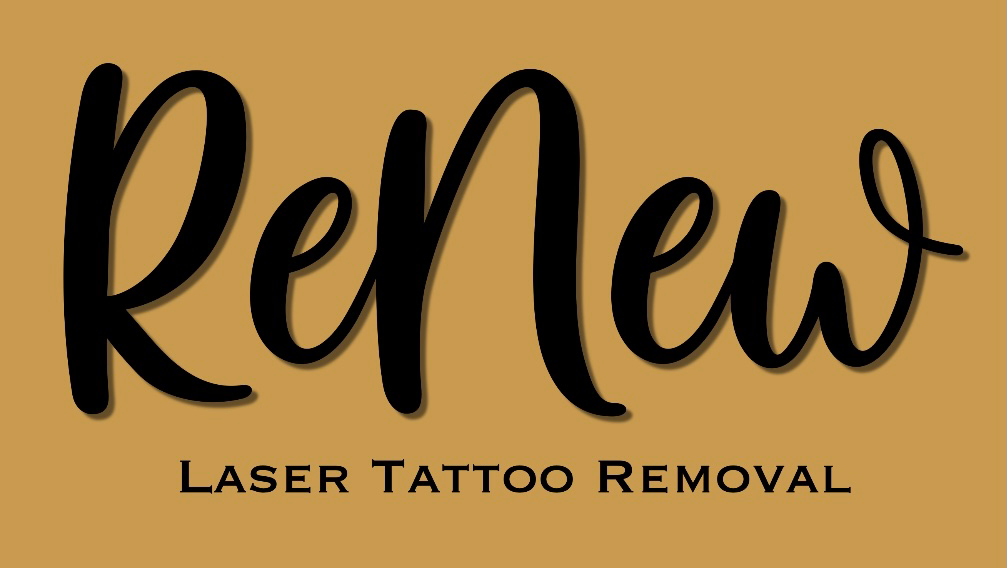 Renew Laser Tattoo Removal | 1/24 Templar Pl, Bennetts Green NSW 2290, Australia | Phone: 0438 586 757