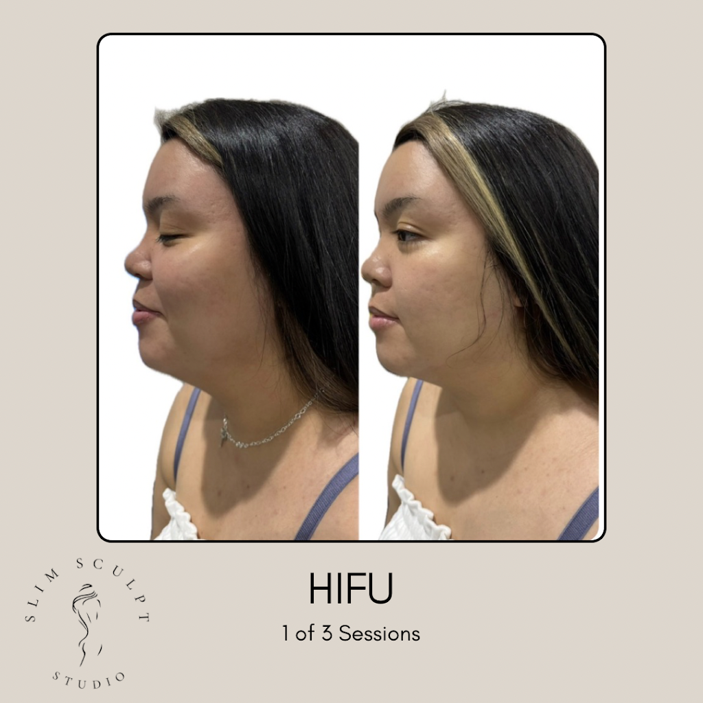 Slim Sculpt Studio | 27 Dilga Cres, Erskine Park NSW 2759, Australia | Phone: 0499 934 410