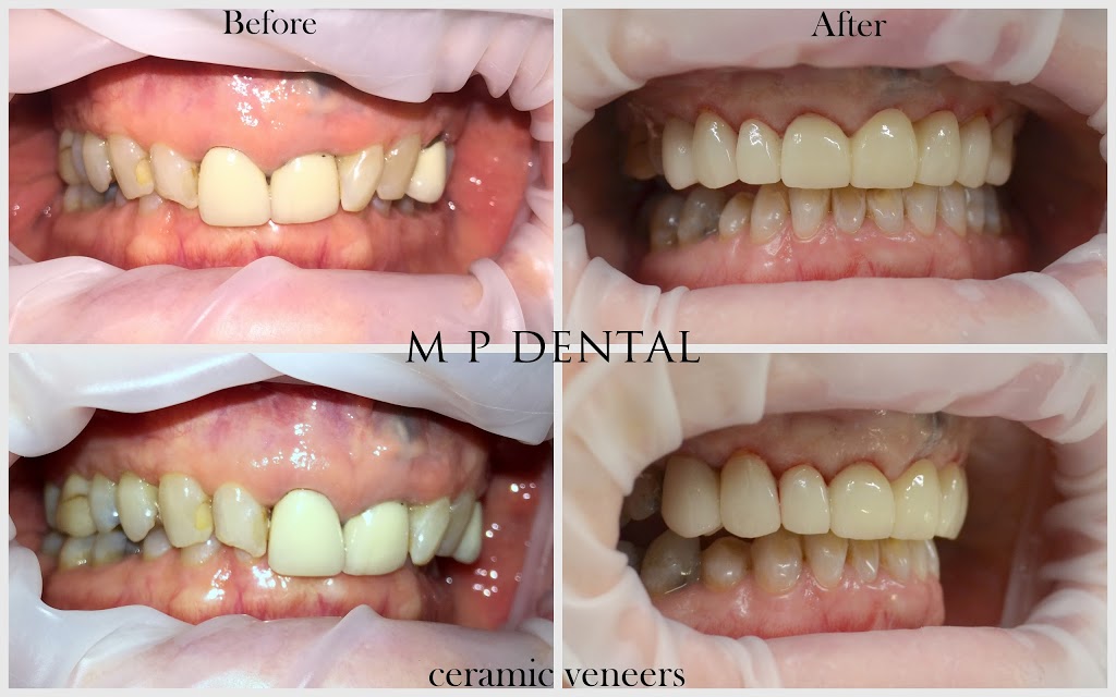 MP Dental Corowa | dentist | 8 River St, Corowa NSW 2646, Australia | 0260331213 OR +61 2 6033 1213