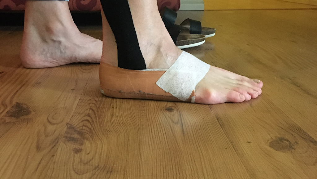 BodyAssist Sports Health (Remedial and Sports Massage) | 31 Orwell St, Brisbane City QLD 4152, Australia | Phone: 0432 843 869