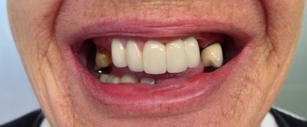 Cernus Dental Clinic & Laboratories | 139 Heaths Rd, Hoppers Crossing VIC 3029, Australia | Phone: (03) 9749 0834