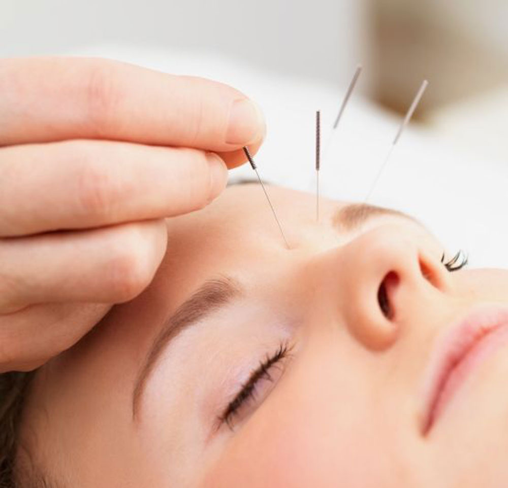 Acupuncture Space | Fertility Pregnancy Family Clinic | Marilyn Ct, Currumbin Waters QLD 4223, Australia | Phone: 0409 916 791