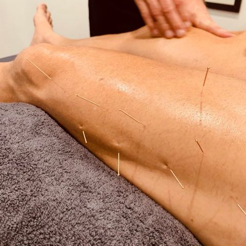 Pin Point Remedial Massage | 22 Clayton Rd, Lammermoor QLD 4703, Australia | Phone: 0406 916 490