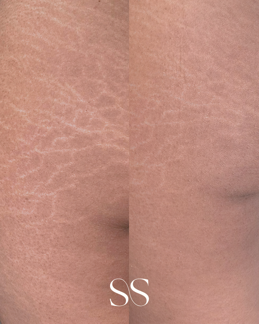 Second Skin By Lauren | 5/141 Maudsland Rd, Oxenford QLD 4210, Australia | Phone: 0480 735 455