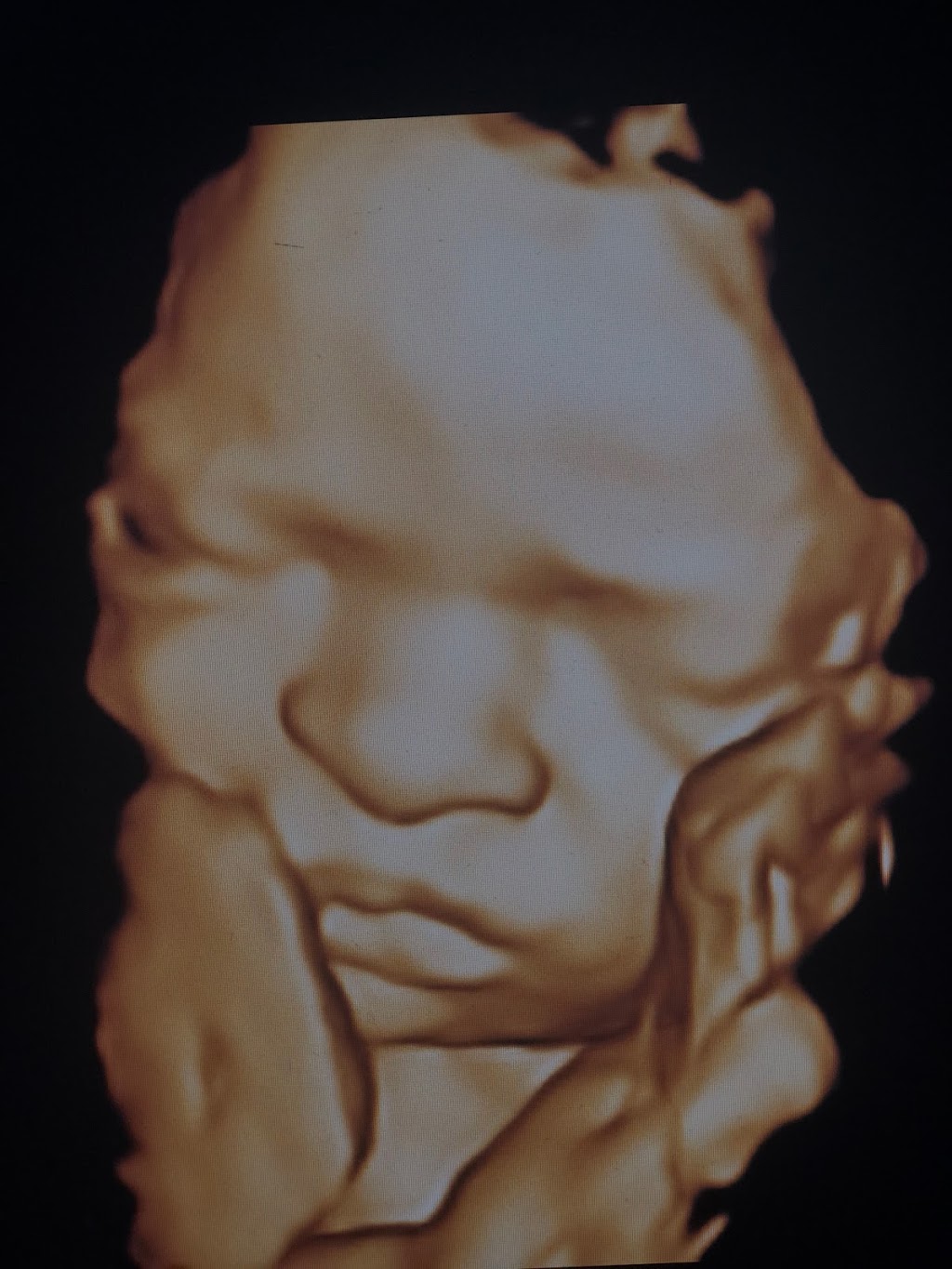 Newcrest Baby Imaging - 3D Baby Ultrasound Scans, Newcastle, NSW | health | 26 Pinchtail St, Chisholm NSW 2322, Australia | 0497077481 OR +61 497 077 481