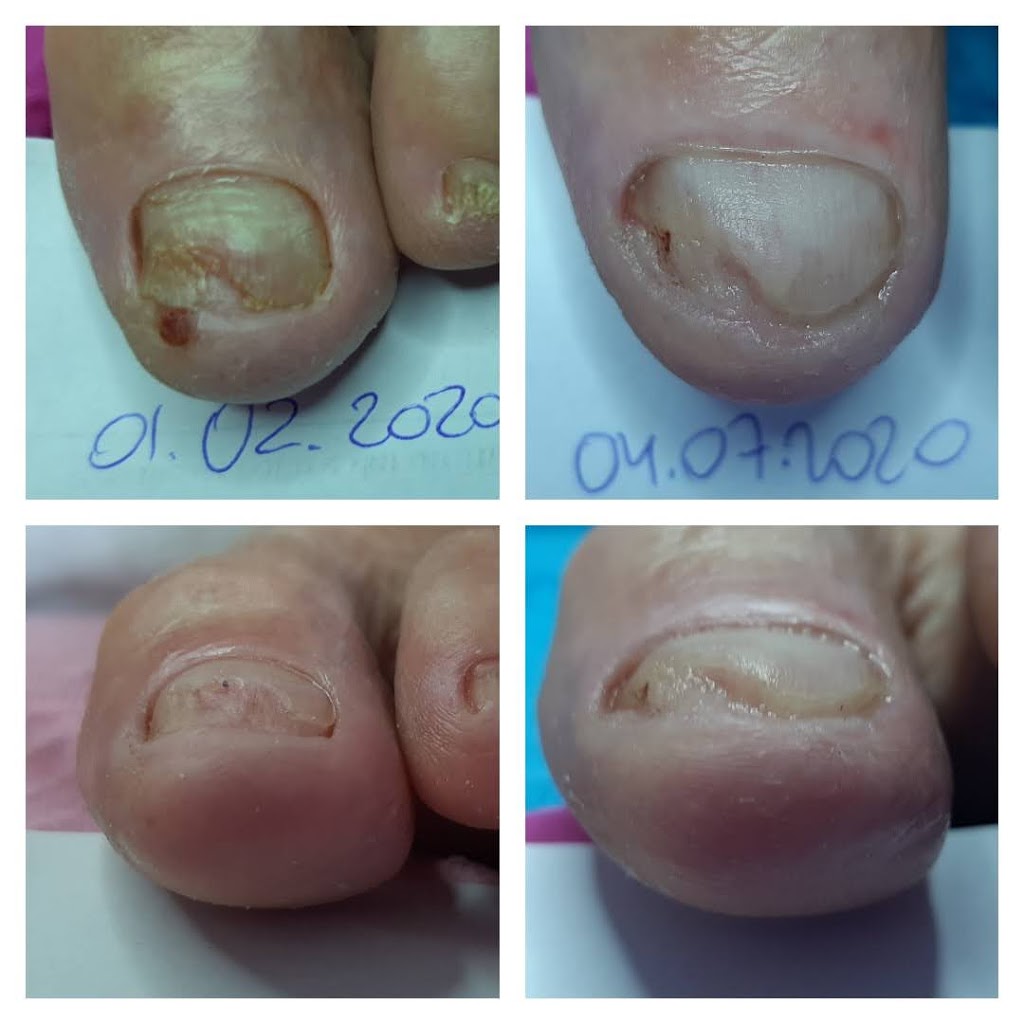 FeetLand Healthy Nails & Feet Berenika Wielowiejska | beauty salon | 18 Lemau Court, Jubilee Pocket QLD 4802, Australia | 0469889718 OR +61 469 889 718