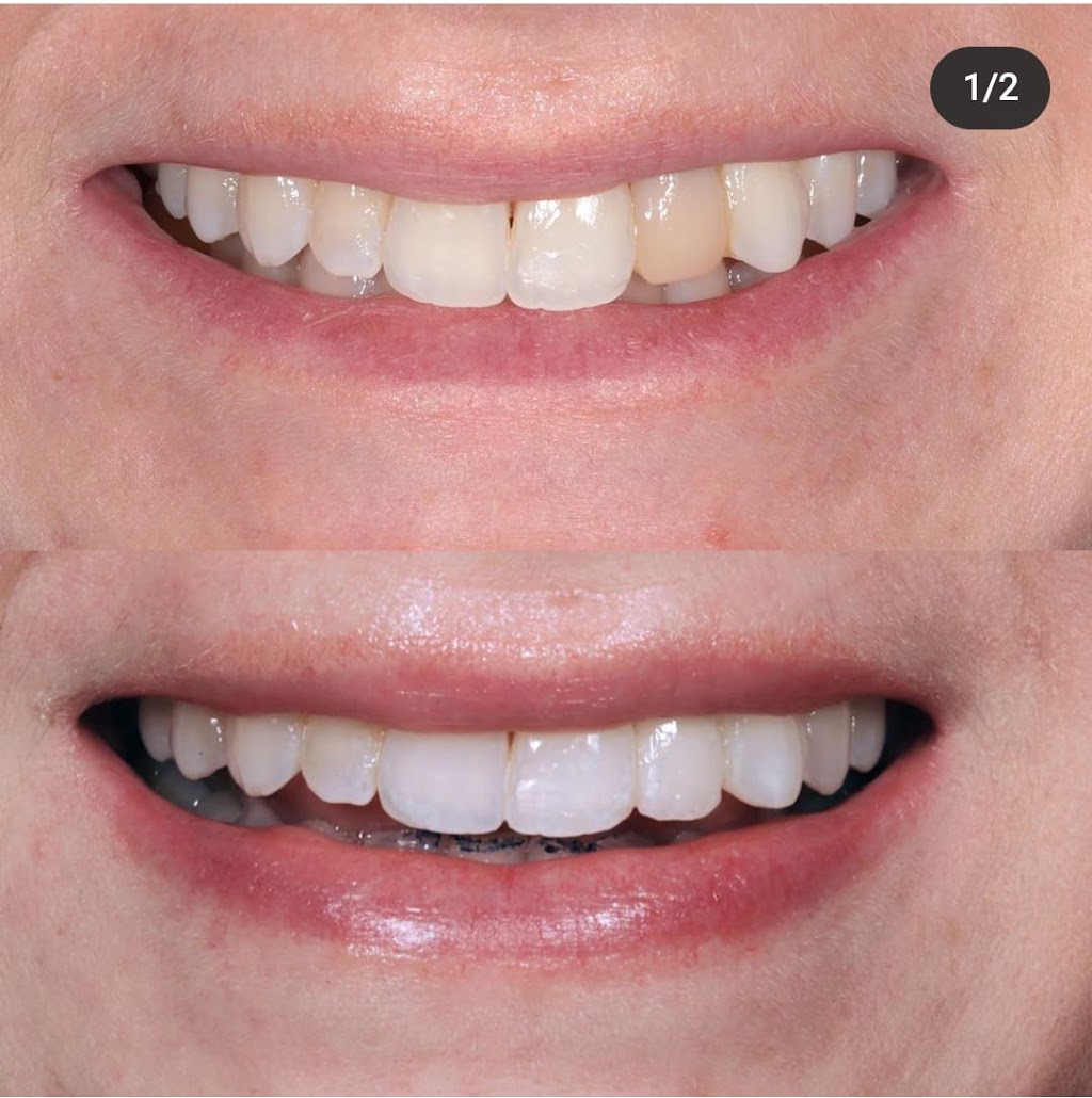 Confident Smile Dental - Dentist Mt Gambier | doctor | 10 Wehl St N, Mount Gambier SA 5290, Australia | 0887256899 OR +61 8 8725 6899