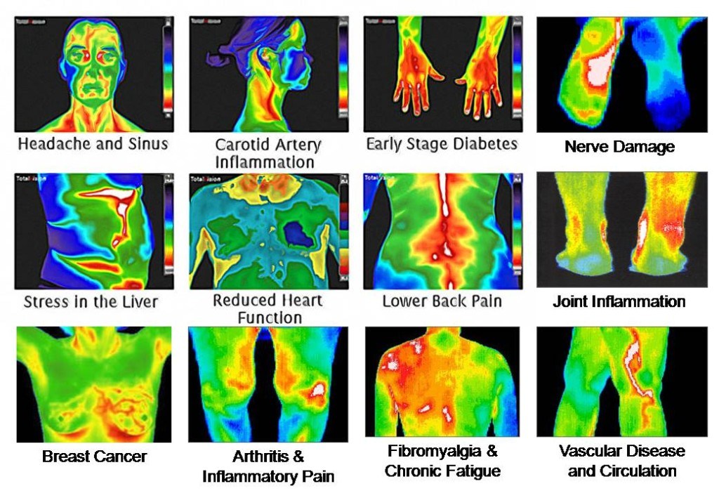 Safe Breast Thermal Imaging - Brisbane | health | 40 Ainsdale St, Chermside West QLD 4032, Australia | 0468462780 OR +61 468 462 780