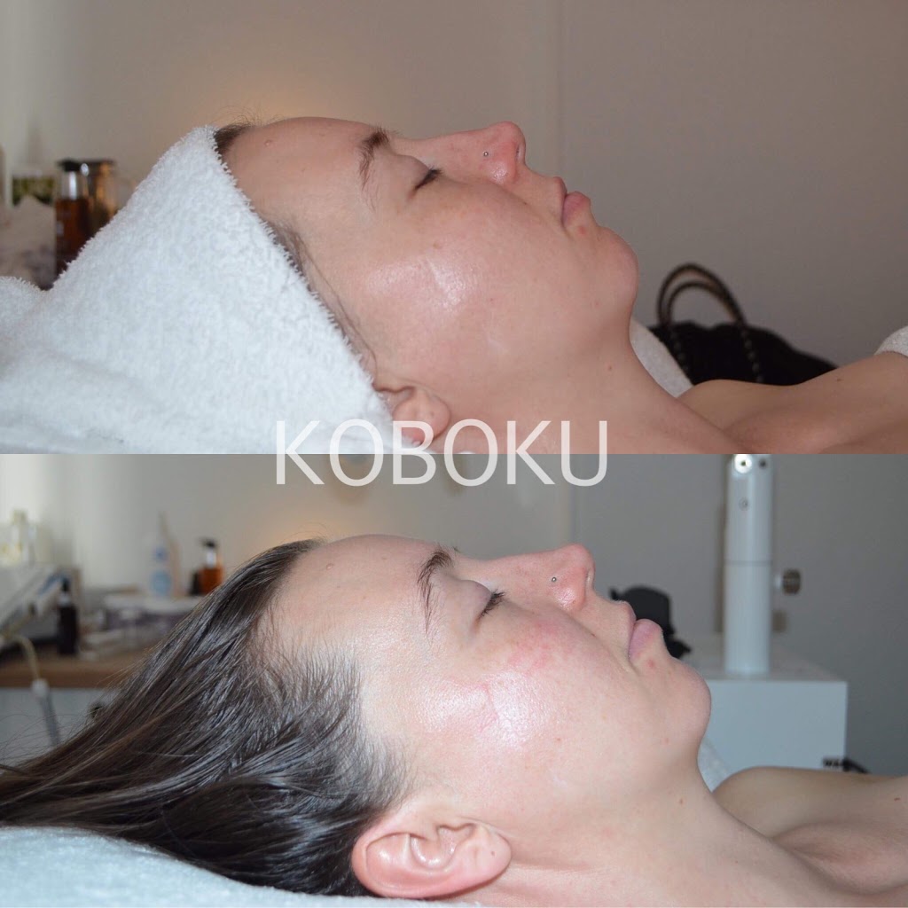 KOBOKU SPA AND LASER | hair care | 8 High St, Lancefield VIC 3435, Australia | 0354292555 OR +61 3 5429 2555