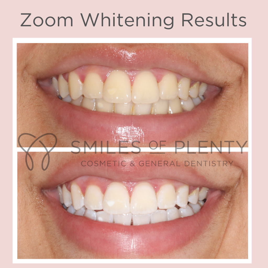 Smiles of Plenty | dentist | 28 Kurrak Rd, Yarrambat VIC 3091, Australia | 0394362949 OR +61 3 9436 2949