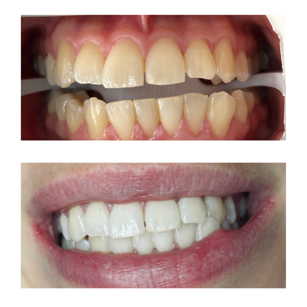 The Whitening Room | MacDougall Rd, Golden Gully VIC 3555, Australia | Phone: 0426 284 861