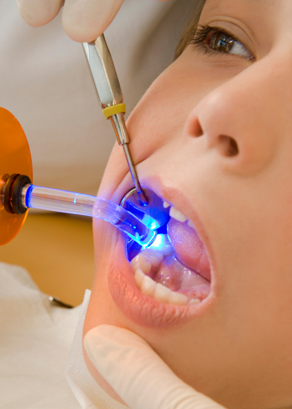 Complete Smile Dental - The Gap | dentist | b/988 Waterworks Rd, The Gap QLD 4061, Australia | 0733003388 OR +61 7 3300 3388