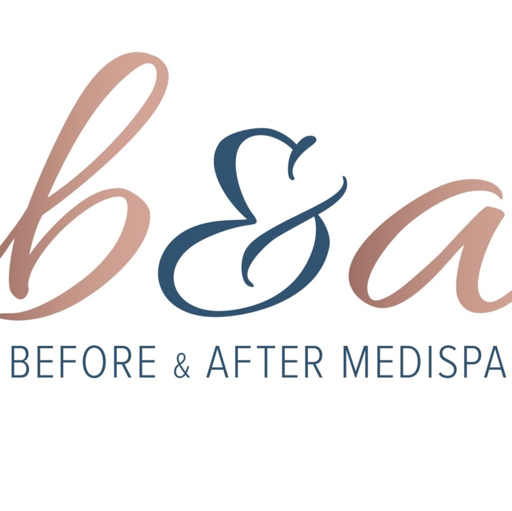 Before and After Medispa | 5/1 Orion St, Balwyn North VIC 3104, Australia | Phone: 0488 030 544