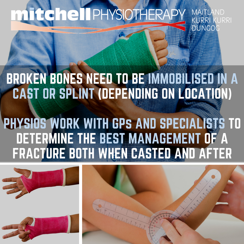 Mitchell Physiotherapy | physiotherapist | 114 Dowling St, Dungog NSW 2420, Australia | 0249921498 OR +61 2 4992 1498
