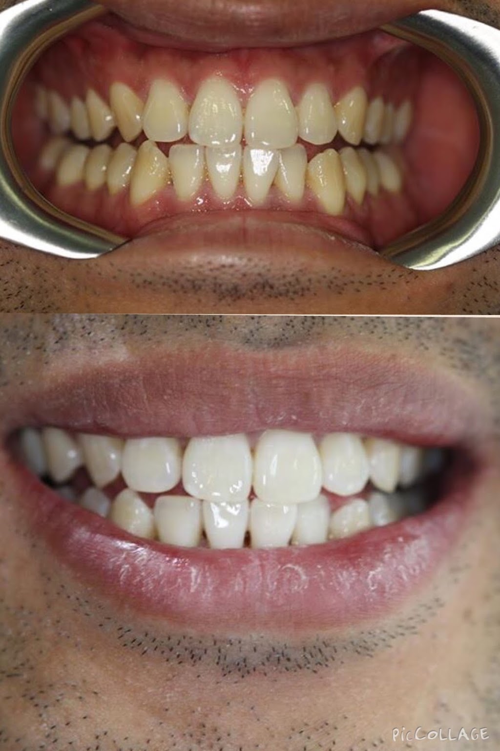 High Dental | dentist | 1187 High St, Armadale VIC 3143, Australia | 0390776363 OR +61 3 9077 6363