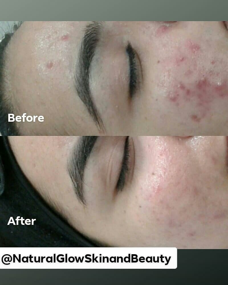 Natural Glow Skin & Beauty (Women Only) | beauty salon | 22 Bigg St, Schofields NSW 2762, Australia | 0435936431 OR +61 435 936 431