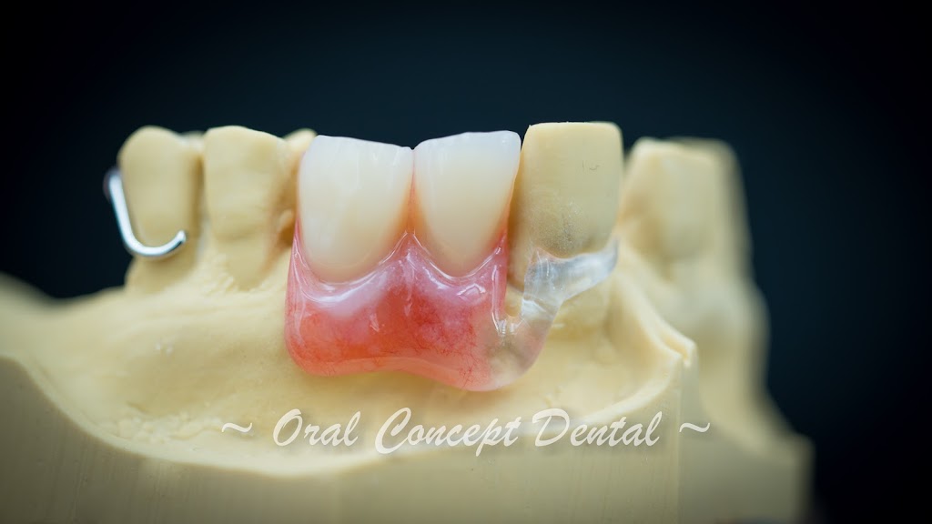 Oral Concept Dental Laboratory | dentist | 25 Whiteside St, Cloverdale WA 6105, Australia | 0892774202 OR +61 8 9277 4202