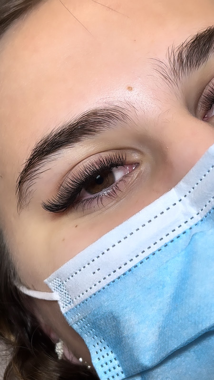 Skulpt Aesthetics | 23 Weemala St, The Gap QLD 4061, Australia | Phone: 0475 114 511