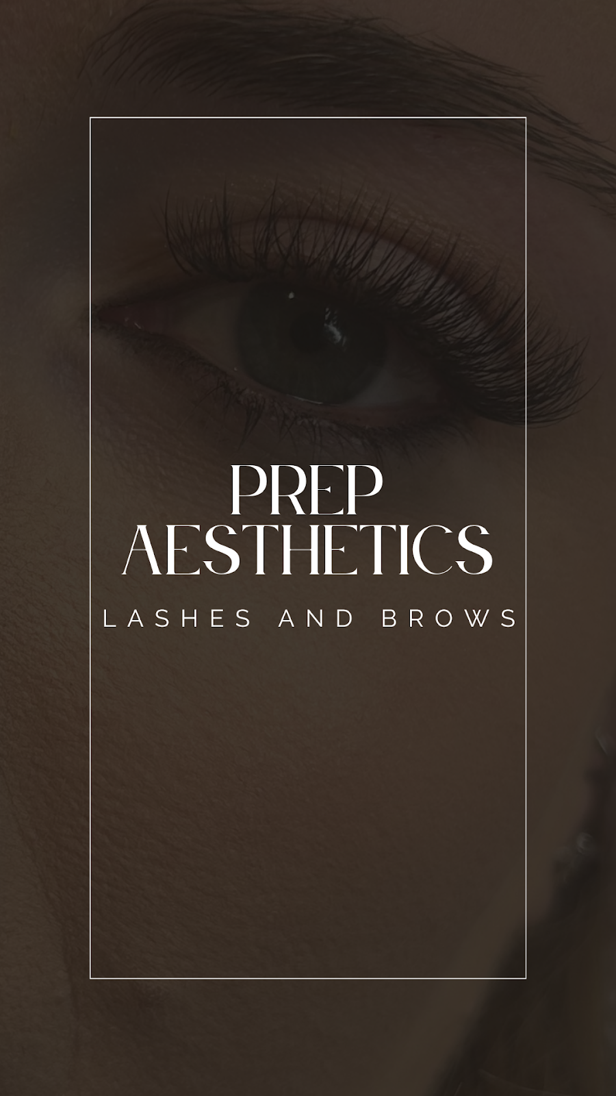 Prep Aesthetics Beauty | Drumalbyn Cl, Wyoming NSW 2250, Australia | Phone: 0421 731 188